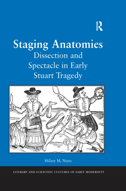 Staging Anatomies : Dissection and Spectacle in Early Stuart Tragedy, PDF eBook