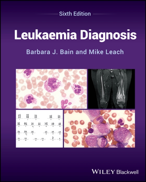 Leukaemia Diagnosis, Hardback Book
