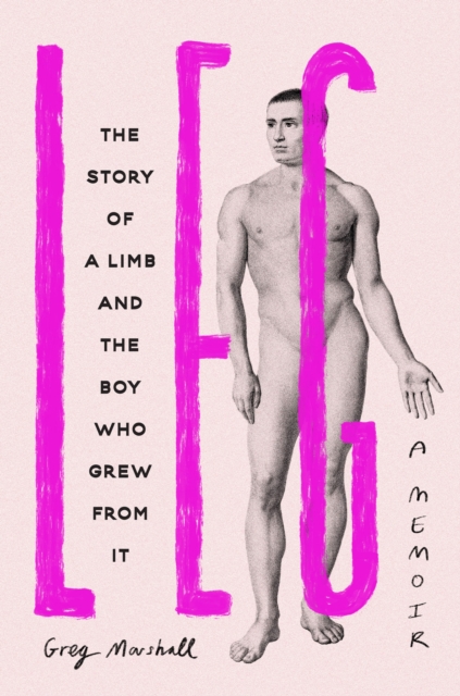Leg : The Story of a Limb and the Boy Who Grew from It, Hardback Book
