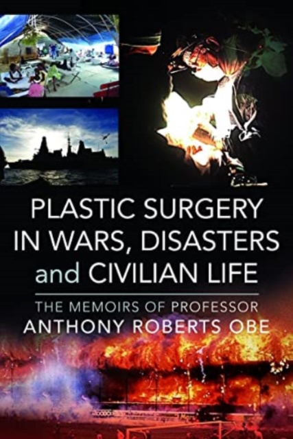 Plastic Surgery in Wars, Disasters and Civilian Life : The Memoirs of Professor Anthony Roberts OBE, Hardback Book