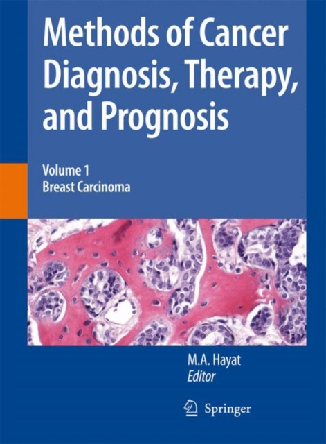 Methods of Cancer Diagnosis, Therapy and Prognosis : Breast Carcinoma, Hardback Book