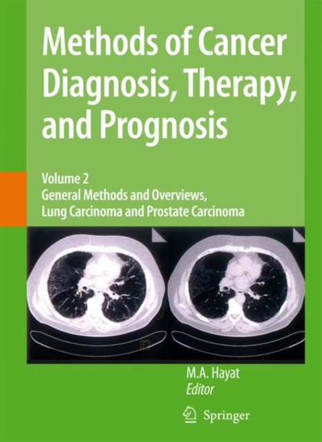 Methods of Cancer Diagnosis, Therapy and Prognosis : General Methods and Overviews, Lung Carcinoma and Prostate Carcinoma, Hardback Book