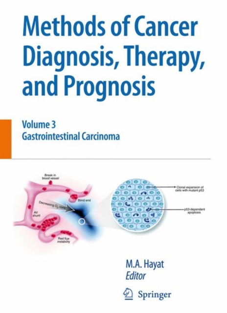 Methods of Cancer Diagnosis, Therapy and Prognosis : Gastrointestinal Cancer, Hardback Book