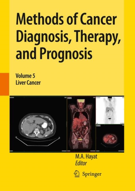 Methods of Cancer Diagnosis, Therapy, and Prognosis : Liver Cancer, Hardback Book