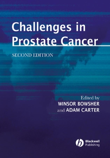 Challenges in Prostate Cancer, Hardback Book