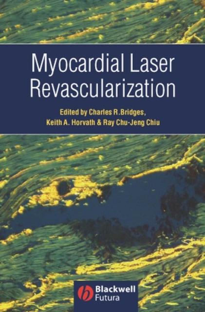 Myocardial Laser Revascularization, Hardback Book
