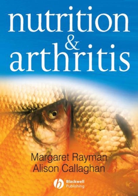 Nutrition and Arthritis, Paperback / softback Book