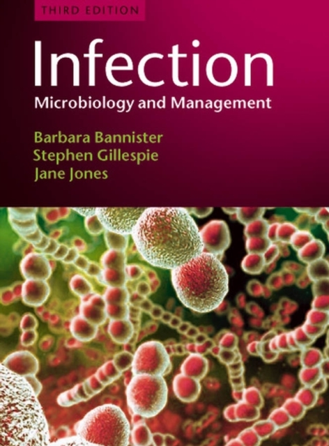 Infection : Microbiology and Management, Paperback / softback Book