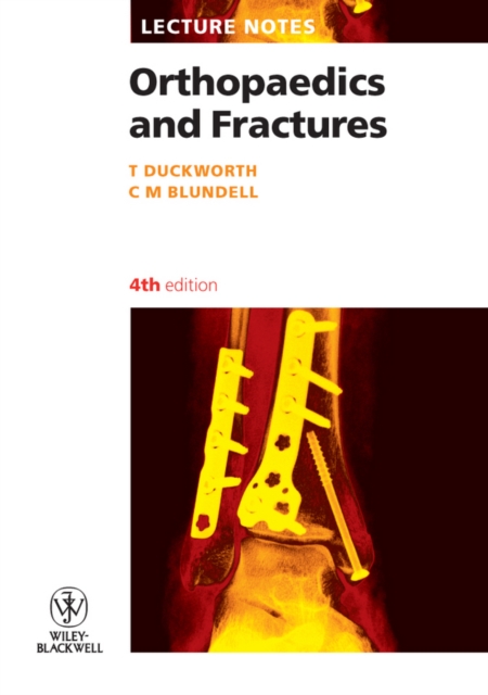 Orthopaedics and Fractures, Paperback / softback Book