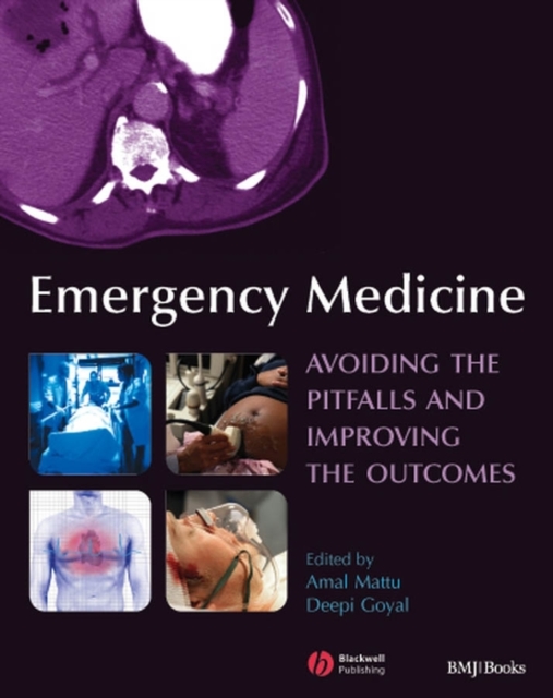 Emergency Medicine : Avoiding the Pitfalls and Improving the Outcomes, Paperback / softback Book