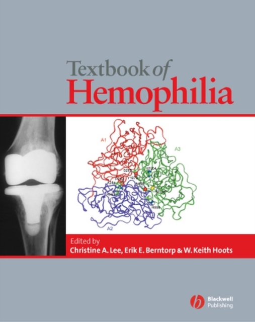 Textbook of Hemophilia, PDF eBook