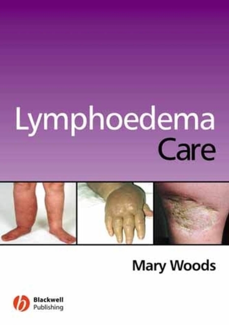 Lymphoedema Care, Paperback / softback Book