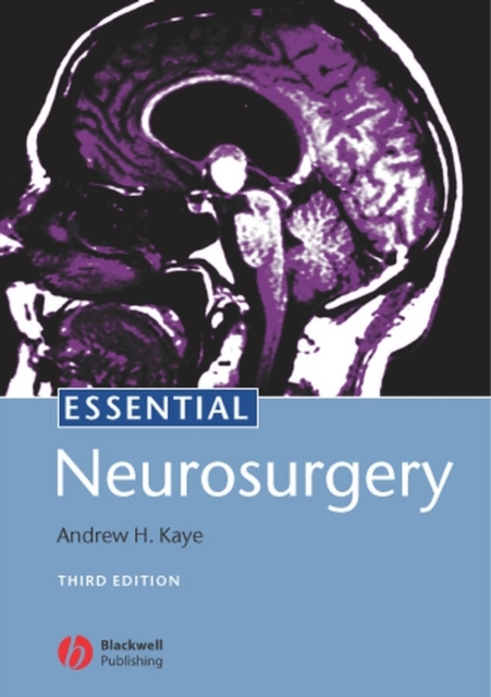 Essential Neurosurgery, PDF eBook