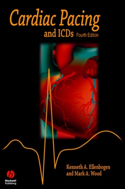 Cardiac Pacing and ICDs, PDF eBook