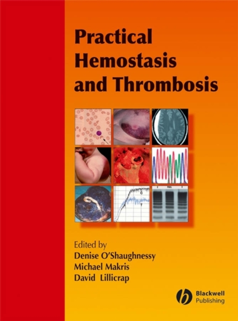 Practical Hemostasis and Thrombosis, PDF eBook
