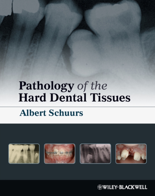 Pathology of the Hard Dental Tissues, Hardback Book