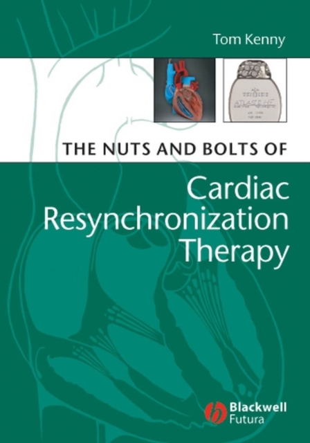 The Nuts and Bolts of Cardiac Resynchronization Therapy, Paperback / softback Book