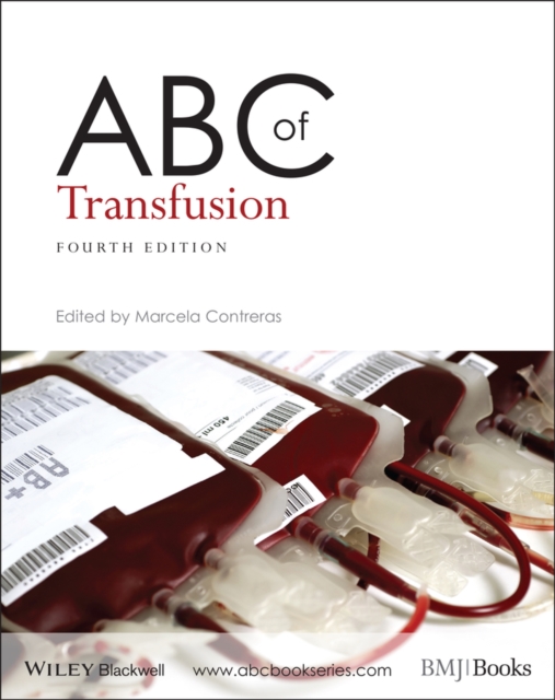 ABC of Transfusion, Paperback / softback Book