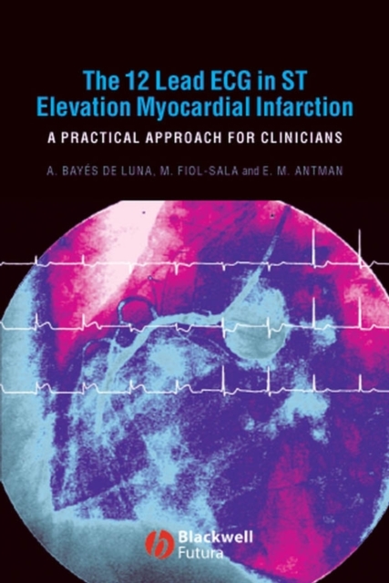 The 12 Lead ECG in ST Elevation Myocardial Infarction : A Practical Approach for Clinicians, Paperback / softback Book