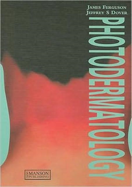 Photodermatology, Hardback Book