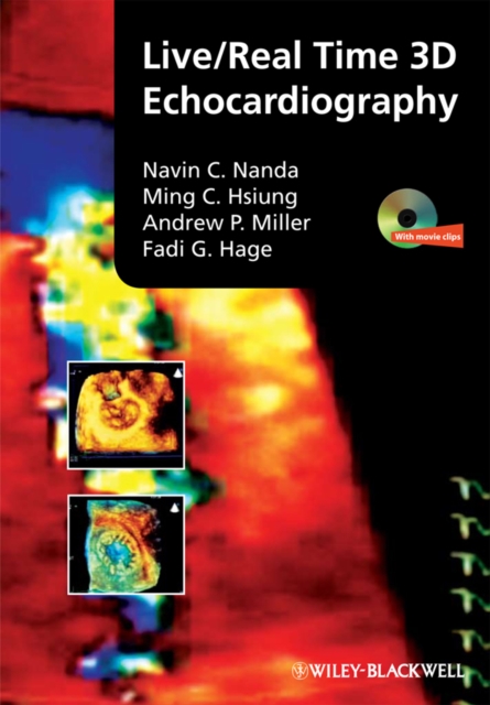 Live/Real Time 3D Echocardiography, Hardback Book