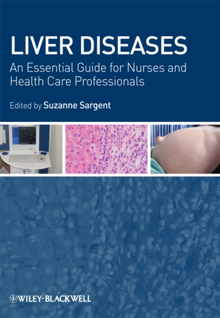 Liver Diseases : An Essential Guide for Nurses and Health Care Professionals, Paperback / softback Book