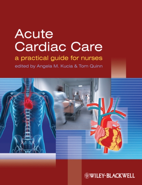 Acute Cardiac Care : A Practical Guide for Nurses, Paperback / softback Book