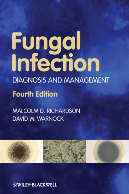 Fungal Infection : Diagnosis and Management, Paperback / softback Book