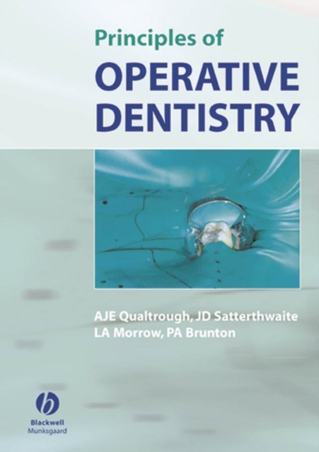 Principles of Operative Dentistry, PDF eBook