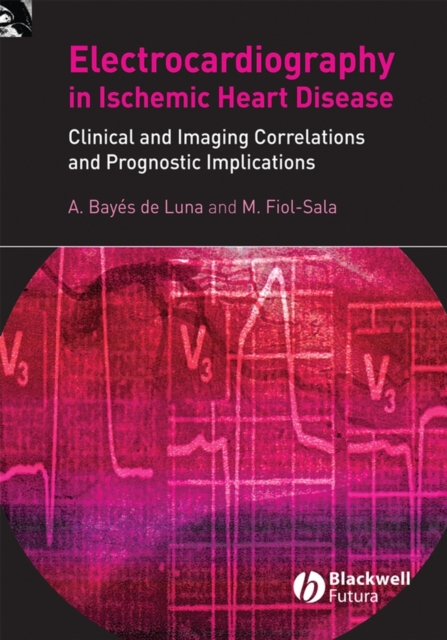 Electrocardiography in Ischemic Heart Disease : Clinical and Imaging Correlations and Prognostic Implications, Hardback Book