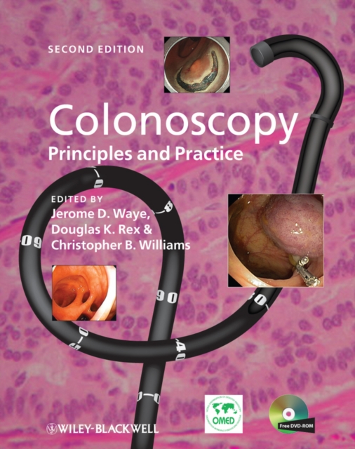Colonoscopy : Principles and Practice, Hardback Book