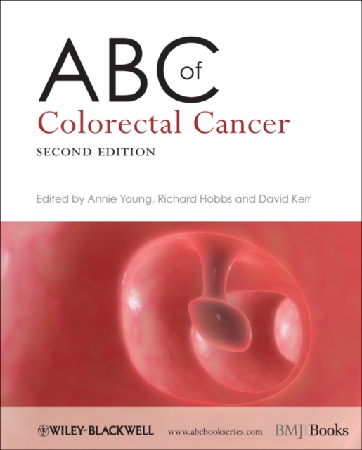 ABC of Colorectal Cancer, Paperback / softback Book