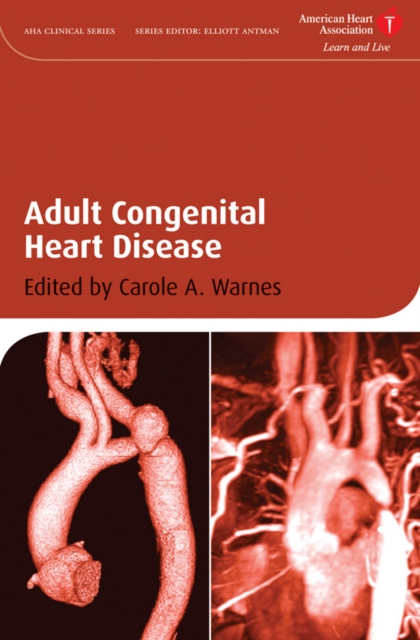 Adult Congenital Heart Disease, Hardback Book