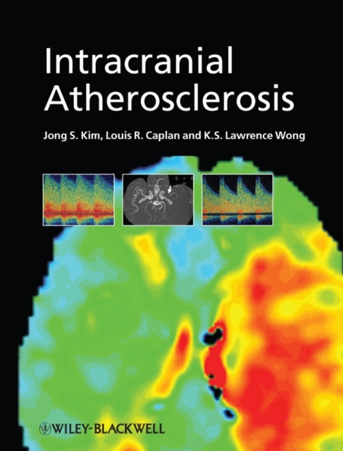 Intracranial Atherosclerosis, Hardback Book