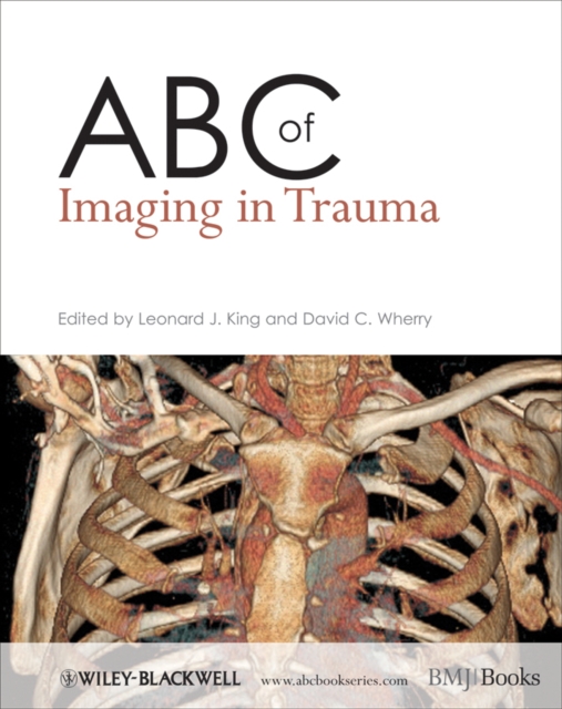 ABC of Imaging in Trauma, Paperback / softback Book