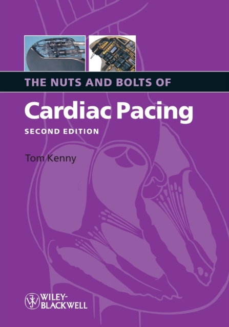 The Nuts and Bolts of Cardiac Pacing, Paperback / softback Book