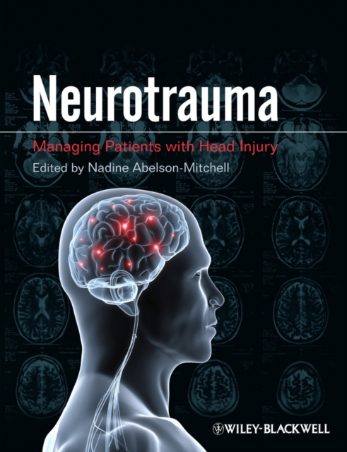 Neurotrauma : Managing Patients with Head Injury, Paperback / softback Book