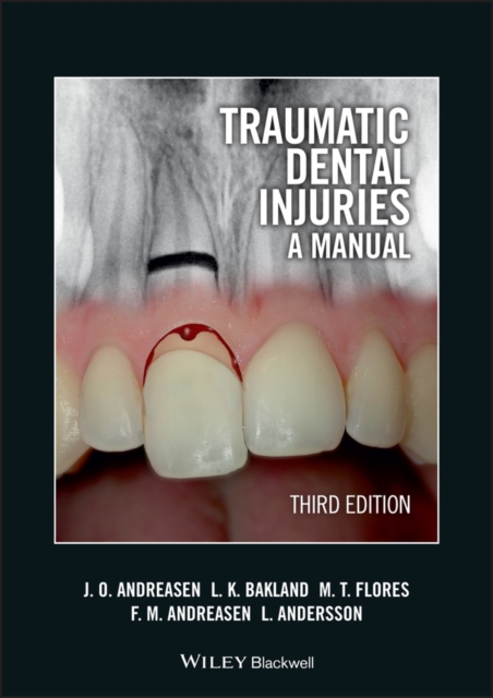 Traumatic Dental Injuries : A Manual, Paperback / softback Book