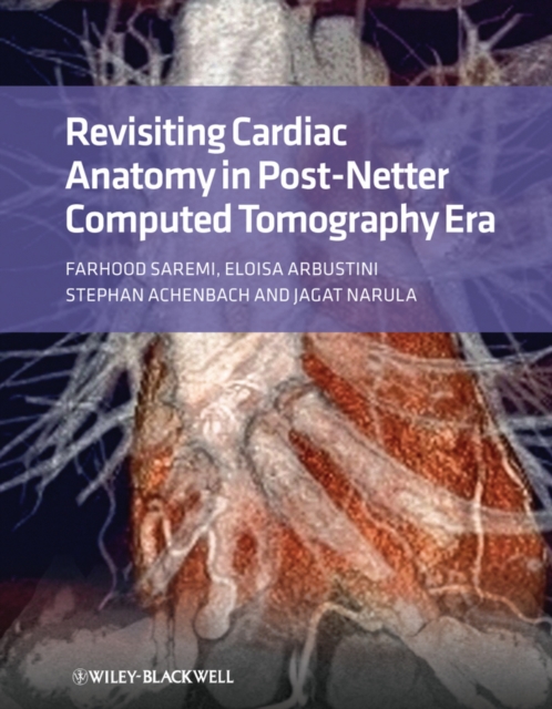 Revisiting Cardiac Anatomy : A Computed-Tomography-Based Atlas and Reference, Hardback Book