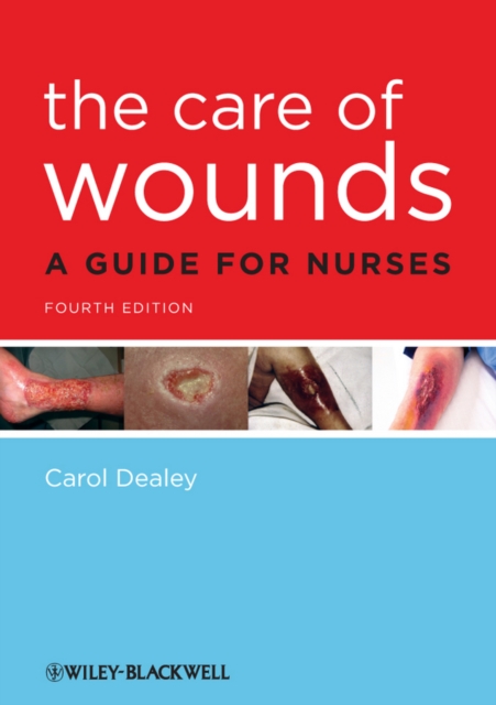 The Care of Wounds : A Guide for Nurses, Paperback / softback Book
