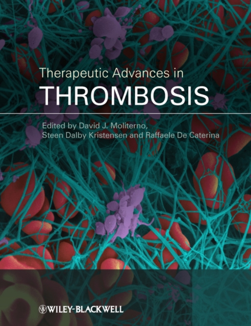 Therapeutic Advances in Thrombosis, Hardback Book