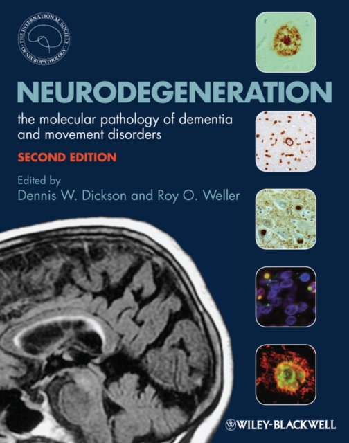 Neurodegeneration : The Molecular Pathology of Dementia and Movement Disorders, Hardback Book