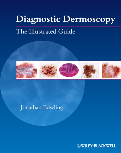 Diagnostic Dermoscopy : The Illustrated Guide, Paperback / softback Book