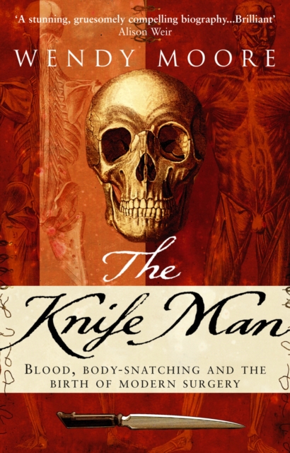The Knife Man, EPUB eBook