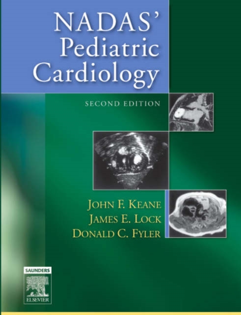 Nadas' Pediatric Cardiology, Hardback Book