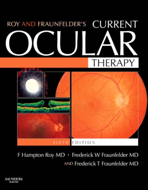 Roy and Fraunfelder's Current Ocular Therapy, Hardback Book