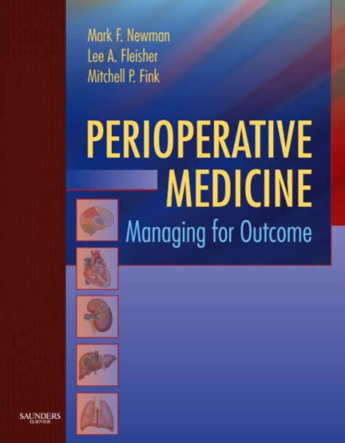Perioperative Medicine : Managing for Outcome, Hardback Book