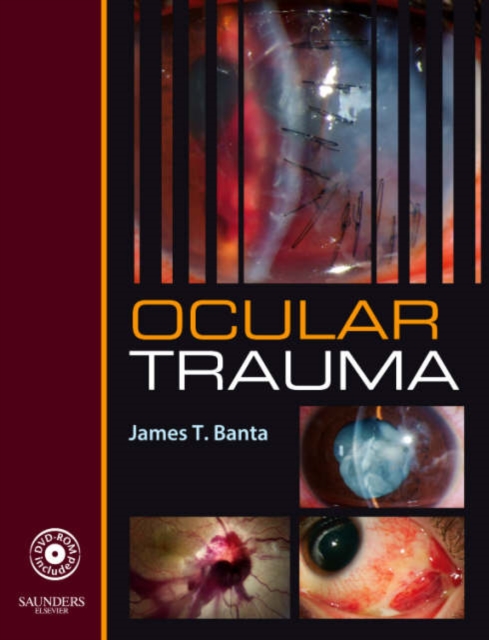 Ocular Trauma, Mixed media product Book