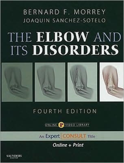 The Elbow and Its Disorders : Expert Consult - Online and Print, Mixed media product Book
