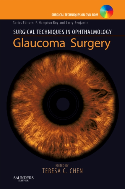 Surgical Techniques in Ophthalmology Series: Glaucoma Surgery : Text with DVD, Hardback Book